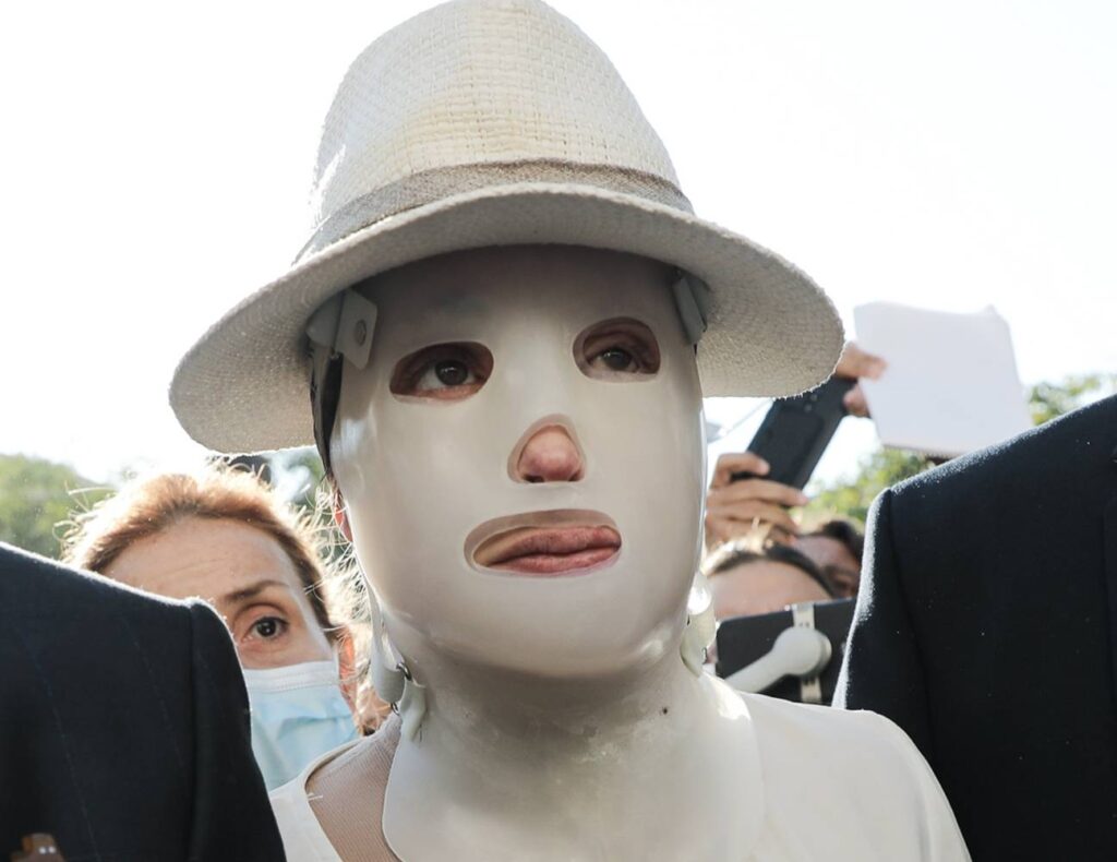 Επίθεση με βιτριόλι: Διεκόπη η δίκη της Ιωάννας – «Αυτή που προσπάθησε να με σκοτώσει απέδειξε πόσο ψυχρή και δειλή είναι»