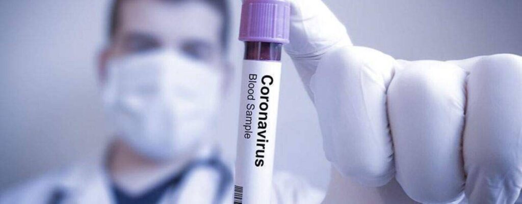 2.383 νέα κρούσματα ανακοίνωσε ο ΕΟΔΥ