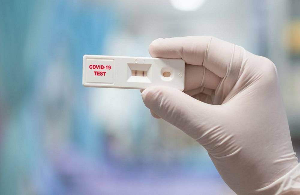 Rapid tests: Πότε υποβάλλεται στο «ΕΡΓΑΝΗ» η υπεύθυνη δήλωση από τις επιχειρήσεις