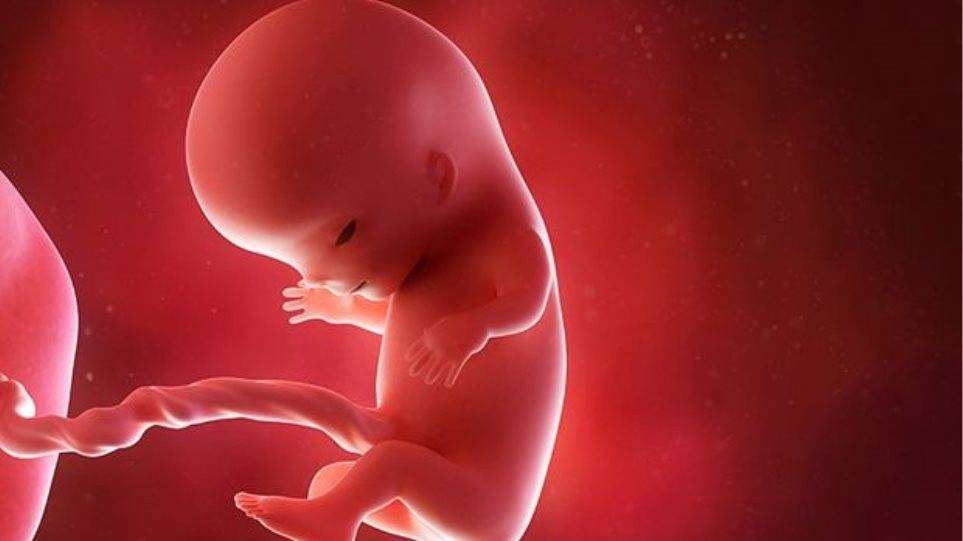 Το Ανώτατο Δικαστήριο των ΗΠΑ ετοιμάζεται να ακυρώσει την απόφαση του 1973 με την οποία αναγνωρίστηκε το δικαίωμα στην άμβλωση