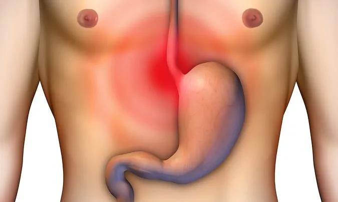 Καούρα στο στομάχι: Τι την προκαλεί , πως να την αντιμετωπίσετε