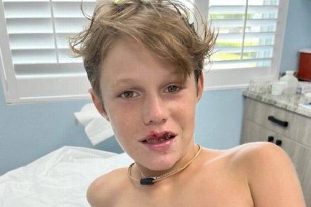 Φλόριντα: Τρομαχτικές στιγμές για ένα 13χρονο όταν καρχαρίας του δάγκωσε το πρόσωπο