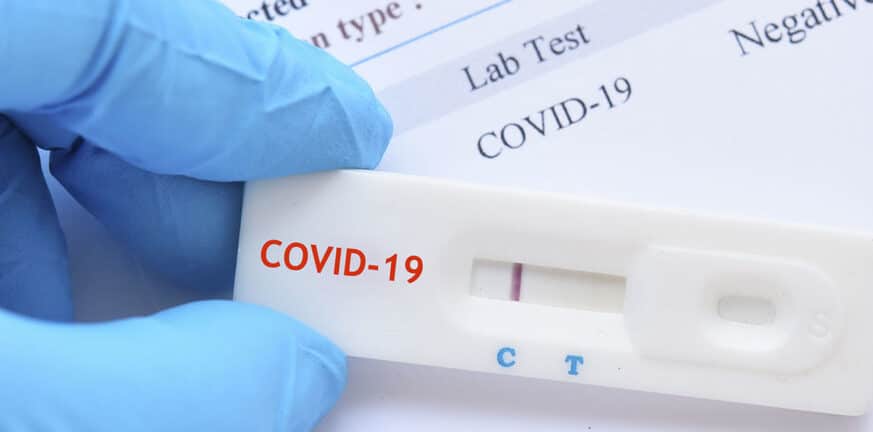 Έρχεται το τέλος των υποχρεωτικών rapid test – Η ημερομηνία του ΦΕΚ