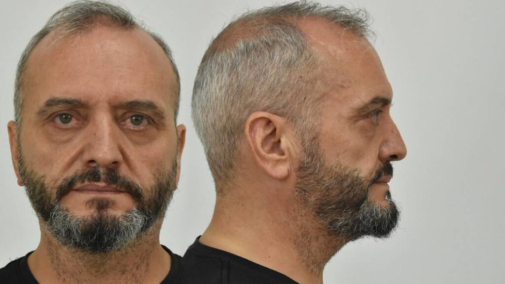 Βιασμός 12χρονης στα Σεπόλια: Για συμπληρωματική απολογία καλείται ο Μίχος