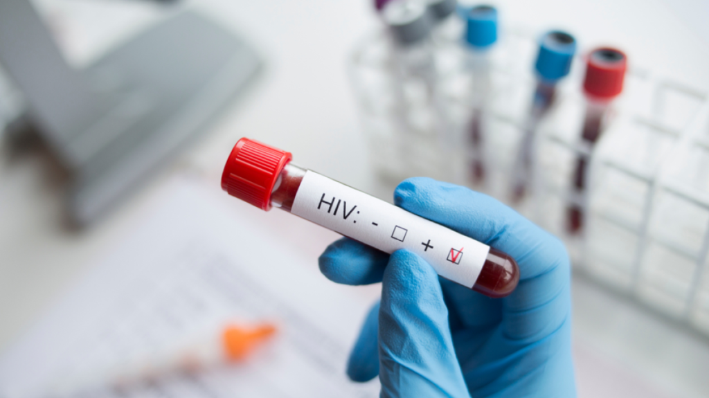 Ρόδος: Φορέας του AIDS κατηγορείται ότι μετέδιδε τη νόσο σε συντρόφους του εν αγνοία τους