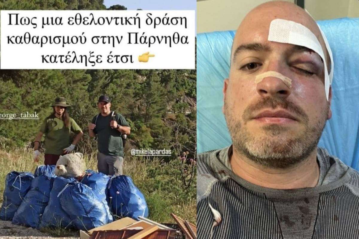 Πάρνηθα: Άγρια επίθεση σε εθελοντές που καθάριζαν την περιοχή - Τους ξυλοκόπησαν και τους μαχαίρωσαν