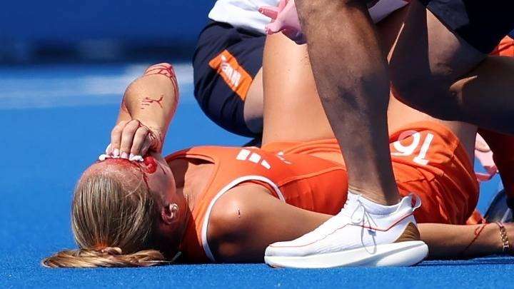 Παρίσι 2024: Σοκαριστικός τραυματισμός στον ημιτελικό γυναικών του χόκεϊ