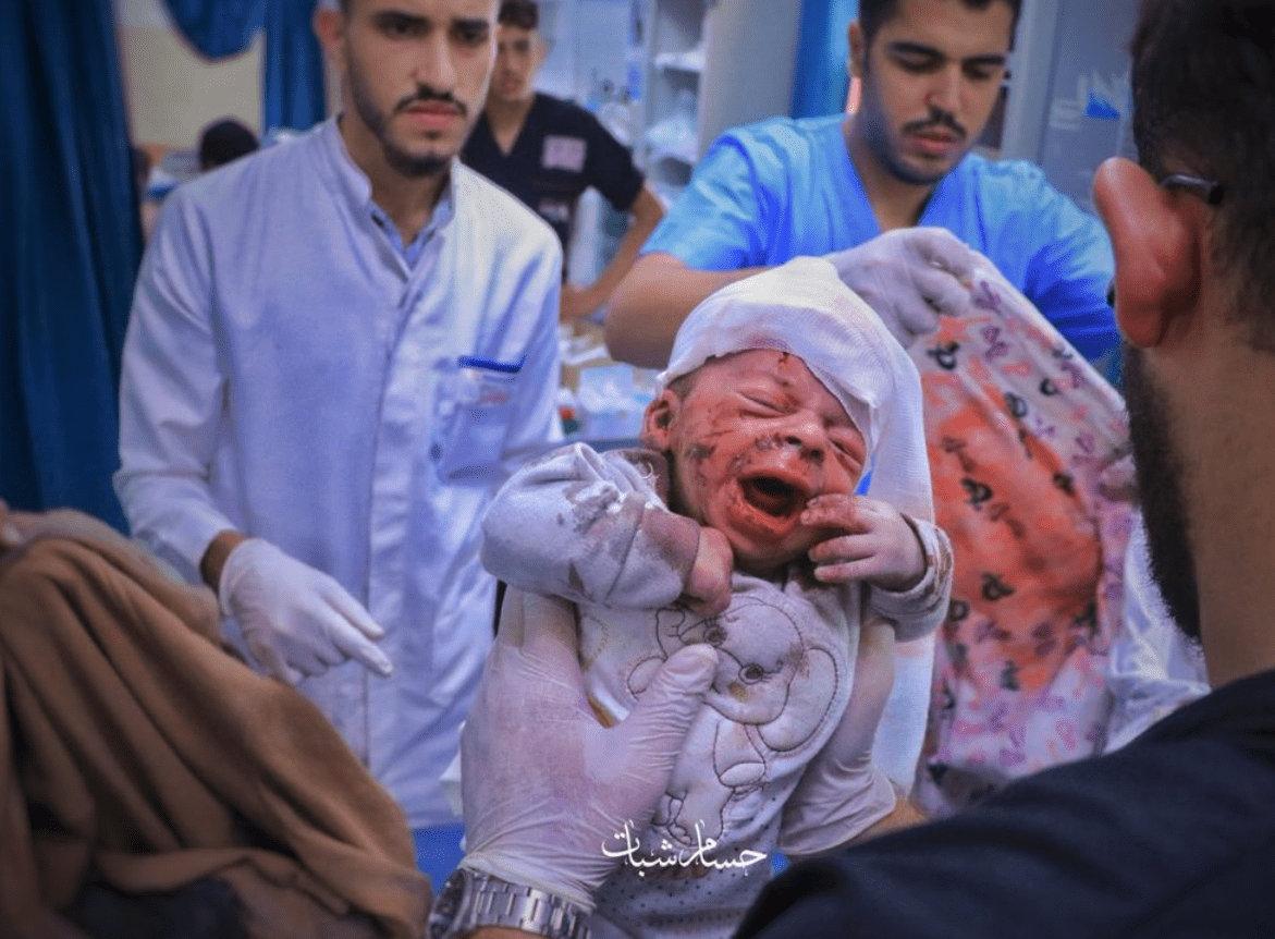 Το Ισραήλ βομβάρδισε το μοναδικό σε λειτουργία νοσοκομείο στη βόρεια Λωρίδα της Γάζας τραυματίζοντας νεογέννητα