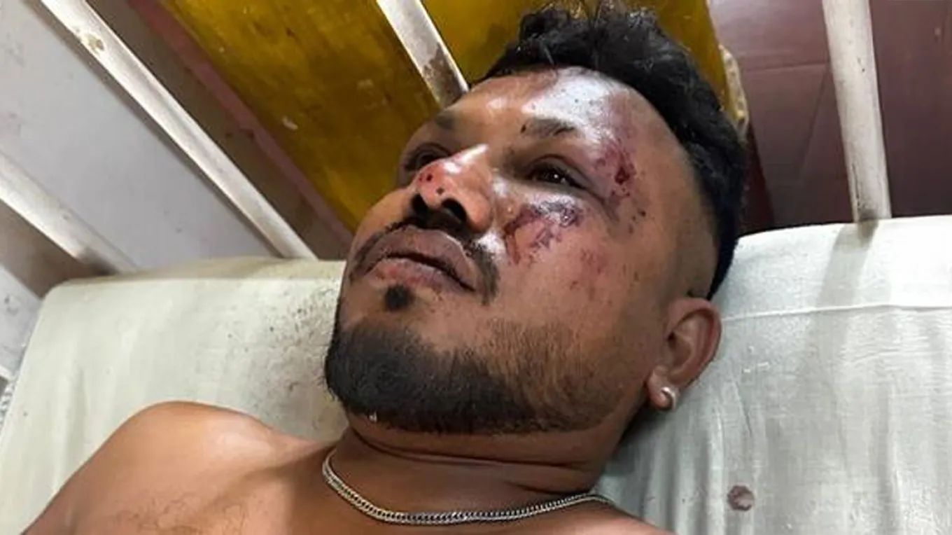 Αυτός είναι ο μοναδικός επιζών της αεροπορικής τραγωδίας στην Ινδία