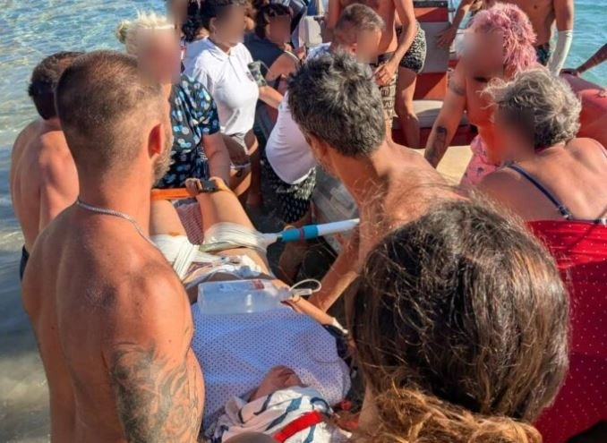 Δονούσα: Ομπρέλα παρασύρθηκε από τον άνεμο και καρφώθηκε στους μηρούς λουόμενης