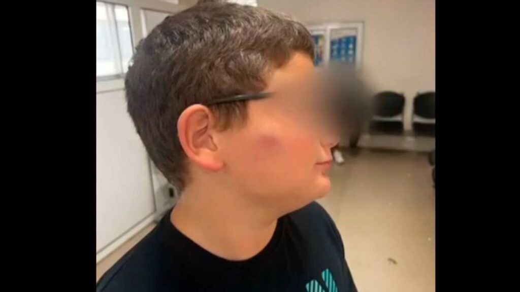 Θεσσαλονίκη: Χτύπησαν με μπουνιές στο κεφάλι 11χρονο συμμαθητή τους